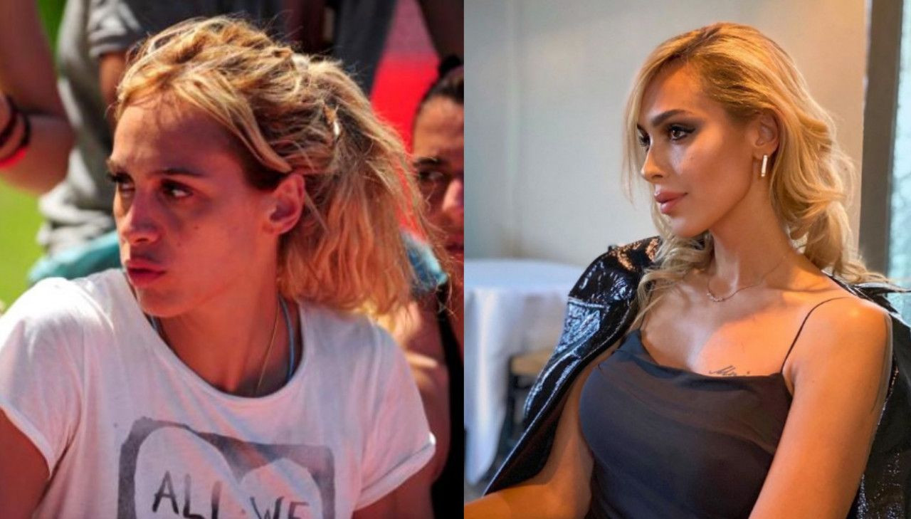 Survivor'un eski yarışmacısı Duygu Bal tanınmaz halde! Estetikle başka birine dönüştü - Sayfa 6
