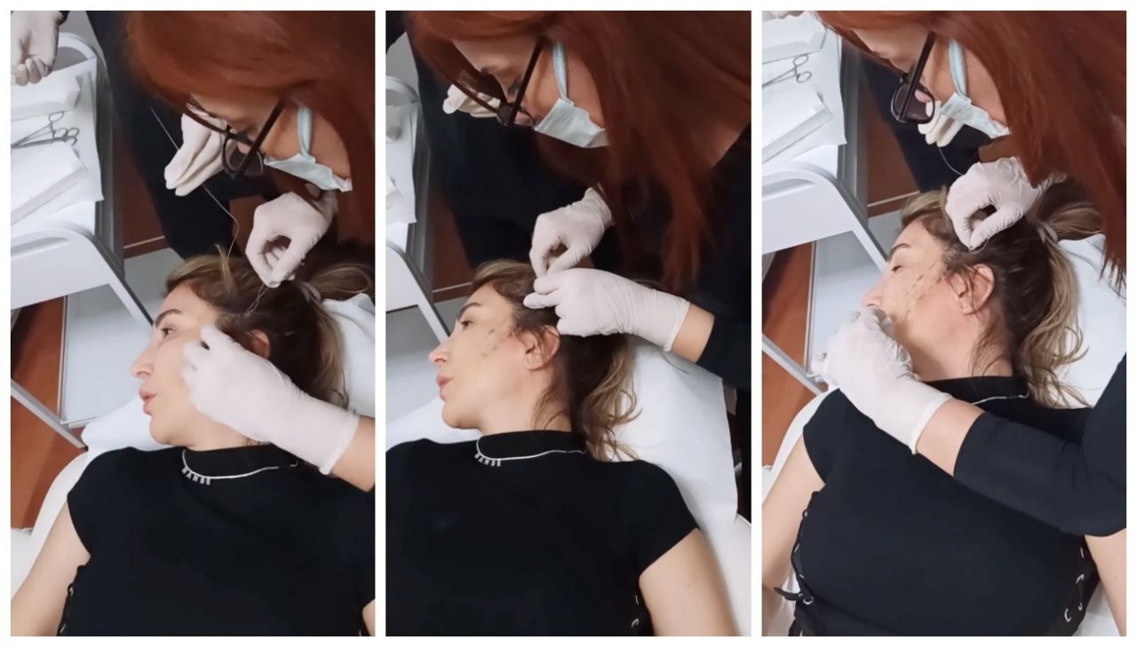 Listenin başında Seda Sayan var! İşte Fransız Askısı estetiği yaptıran ünlü isimler - Sayfa 7