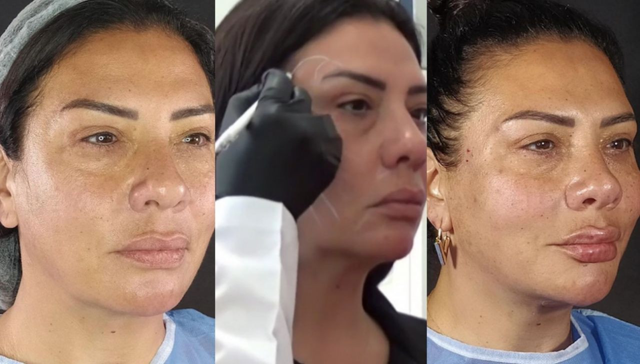 Listenin başında Seda Sayan var! İşte Fransız Askısı estetiği yaptıran ünlü isimler - Sayfa 6