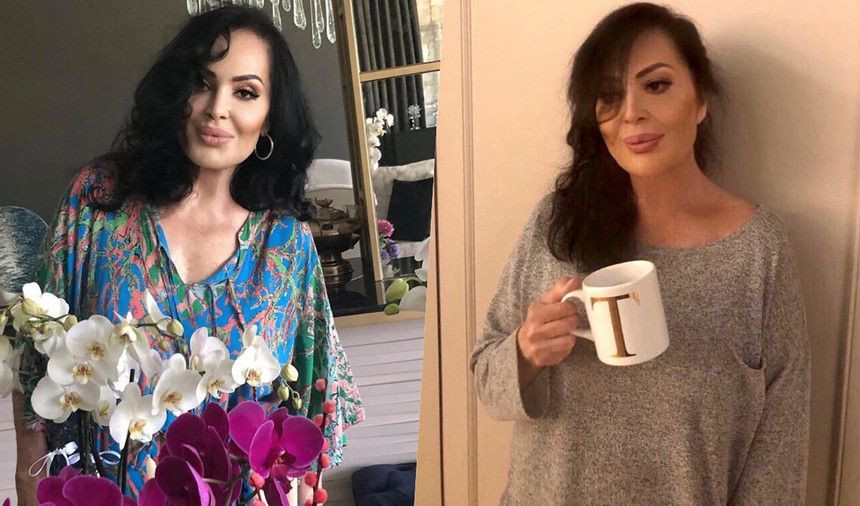 Listenin başında Seda Sayan var! İşte Fransız Askısı estetiği yaptıran ünlü isimler - Sayfa 5