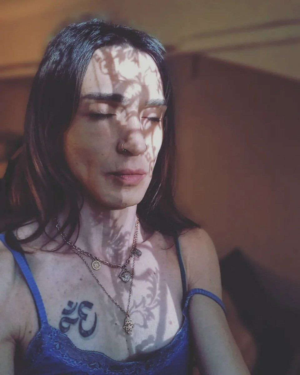 Trans birey olan Ahmet Melih Yılmaz'ın inanılmaz değişimi! Son halini tanıyamayacaksınız - Sayfa 17