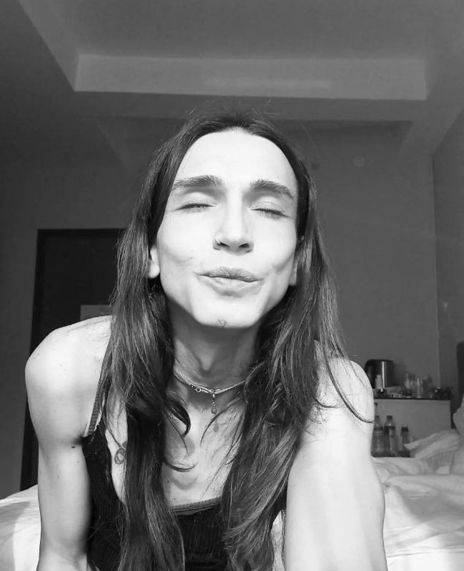 Trans birey olan Ahmet Melih Yılmaz'ın inanılmaz değişimi! Son halini tanıyamayacaksınız - Sayfa 15