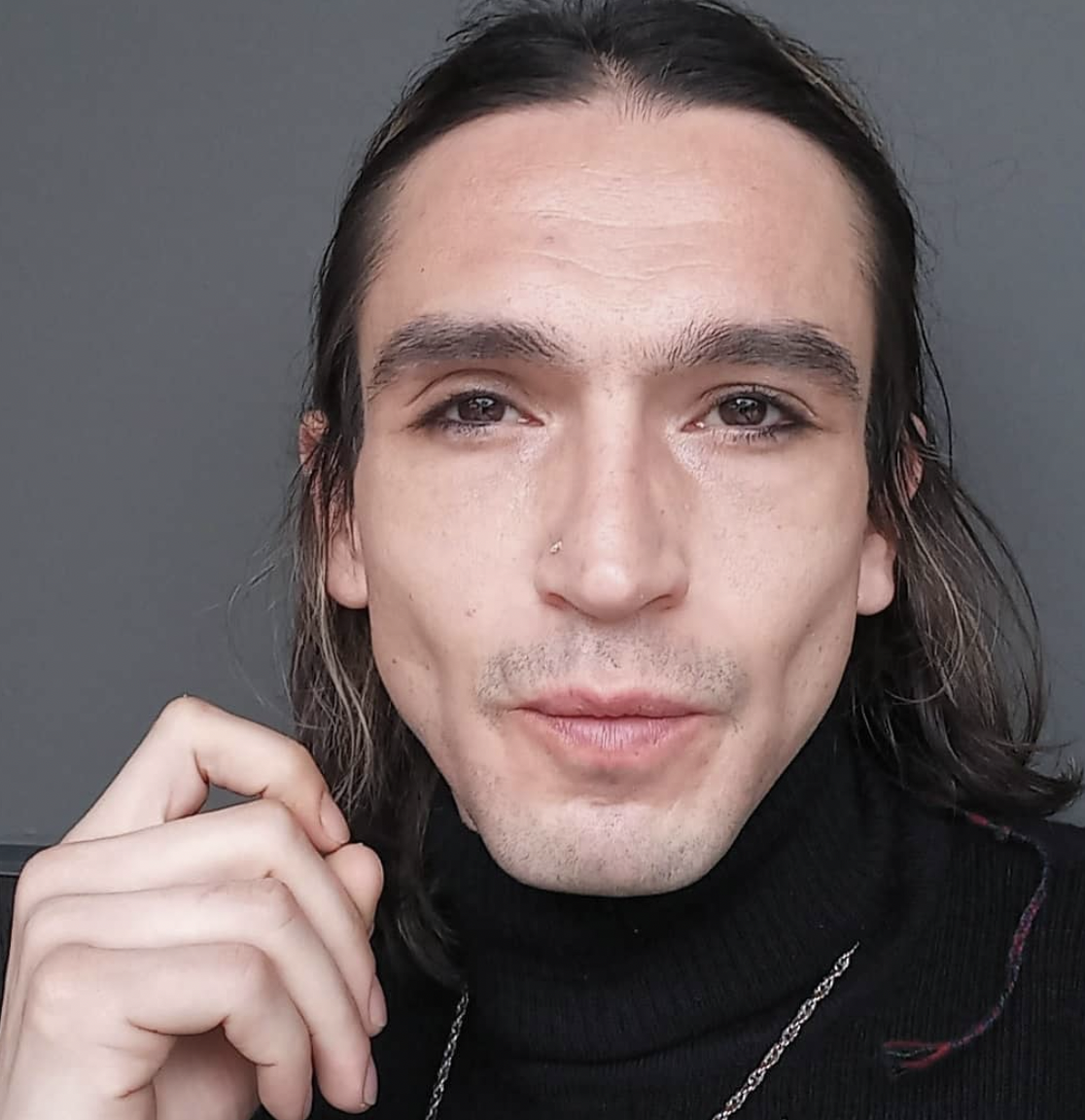 Trans birey olan Ahmet Melih Yılmaz'ın inanılmaz değişimi! Son halini tanıyamayacaksınız - Sayfa 22