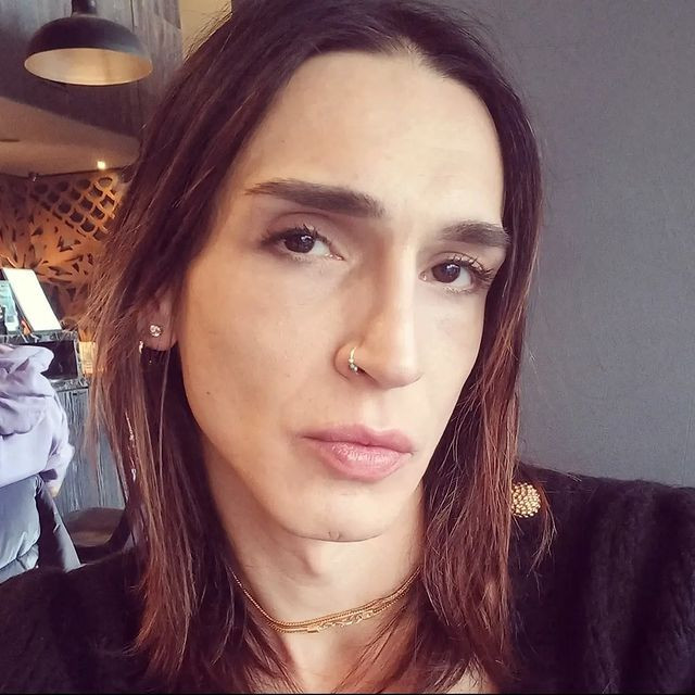 Trans birey olan Ahmet Melih Yılmaz'ın inanılmaz değişimi! Son halini tanıyamayacaksınız - Sayfa 26