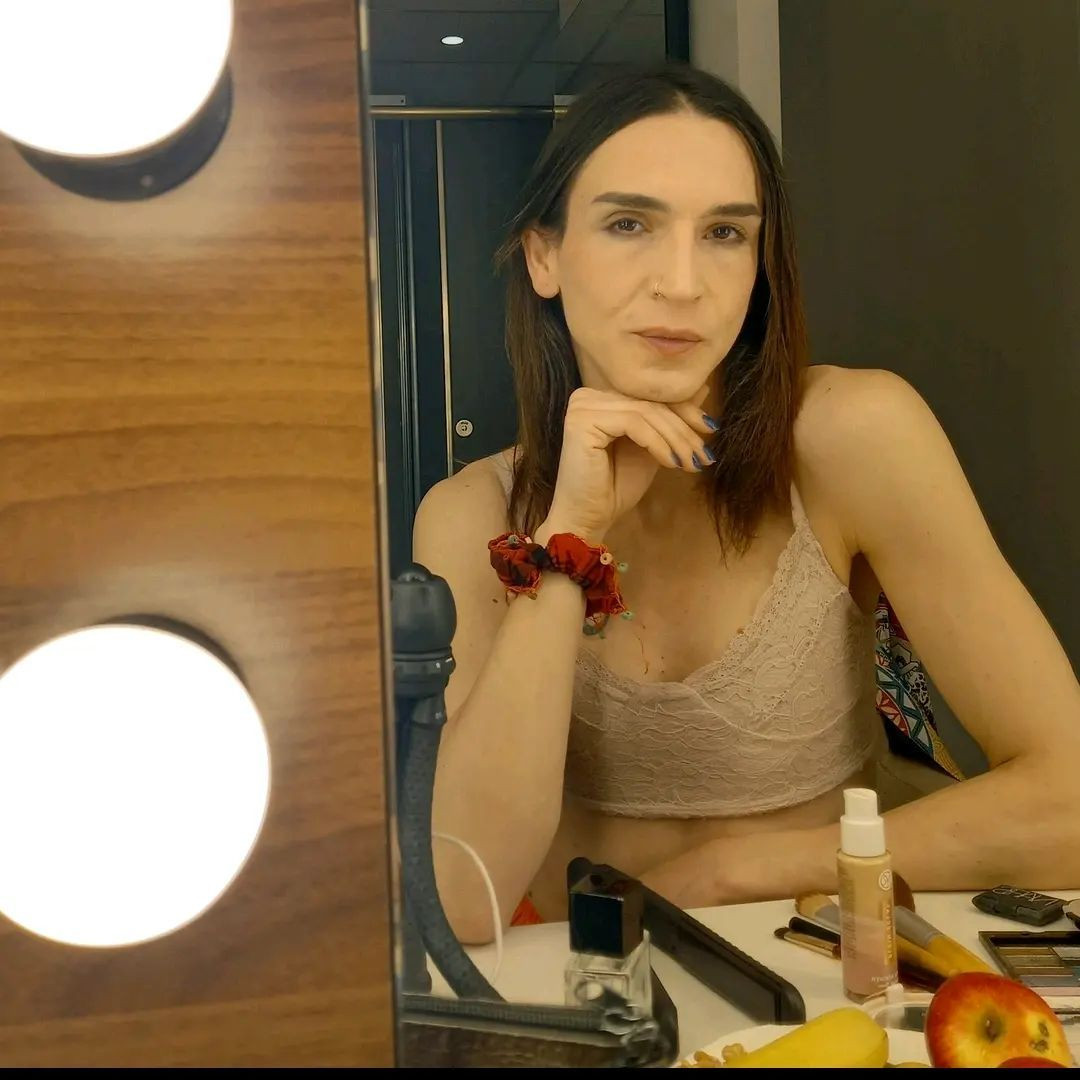 Trans birey olan Ahmet Melih Yılmaz'ın inanılmaz değişimi! Son halini tanıyamayacaksınız - Sayfa 27