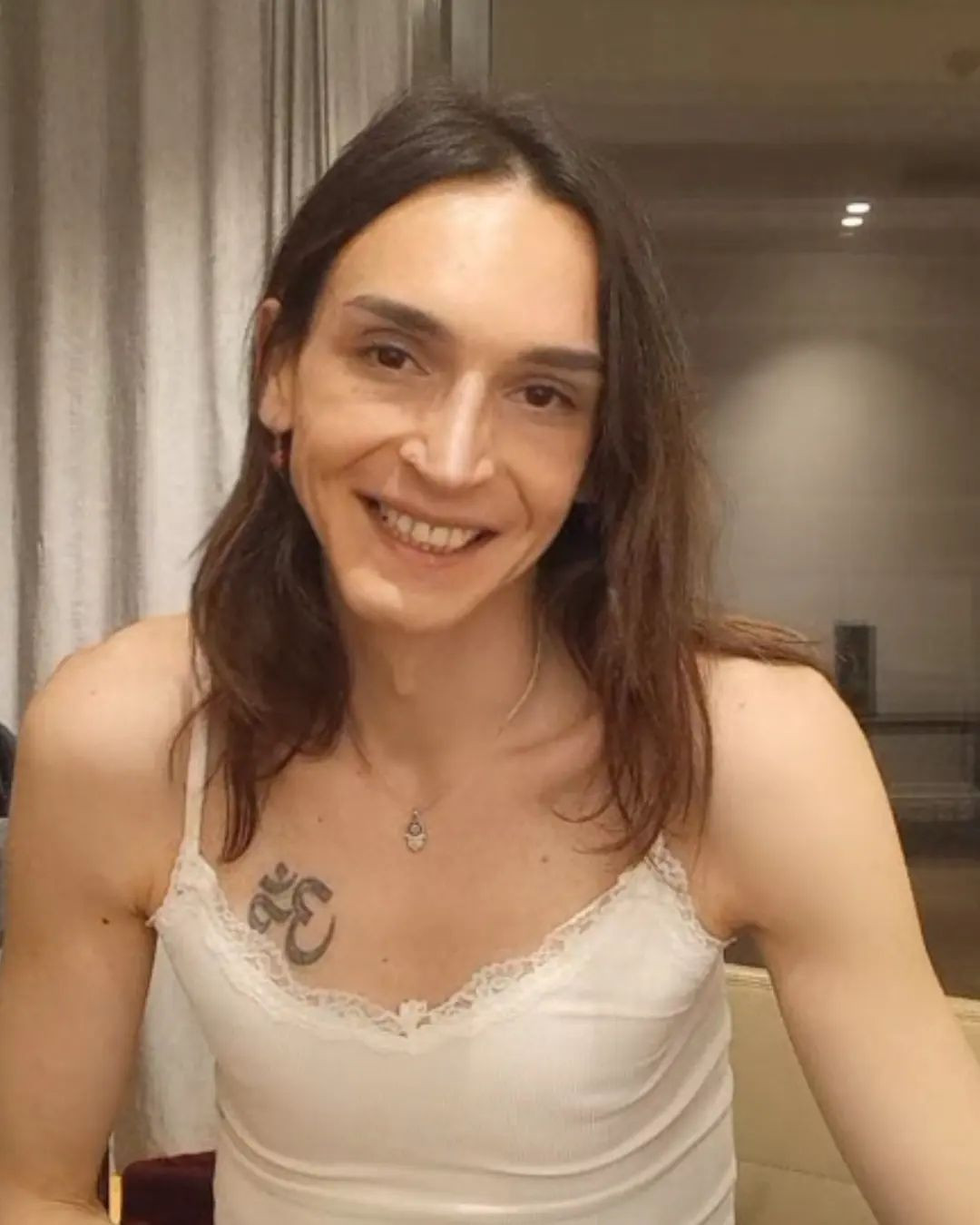 Trans birey olan Ahmet Melih Yılmaz'ın inanılmaz değişimi! Son halini tanıyamayacaksınız - Sayfa 28