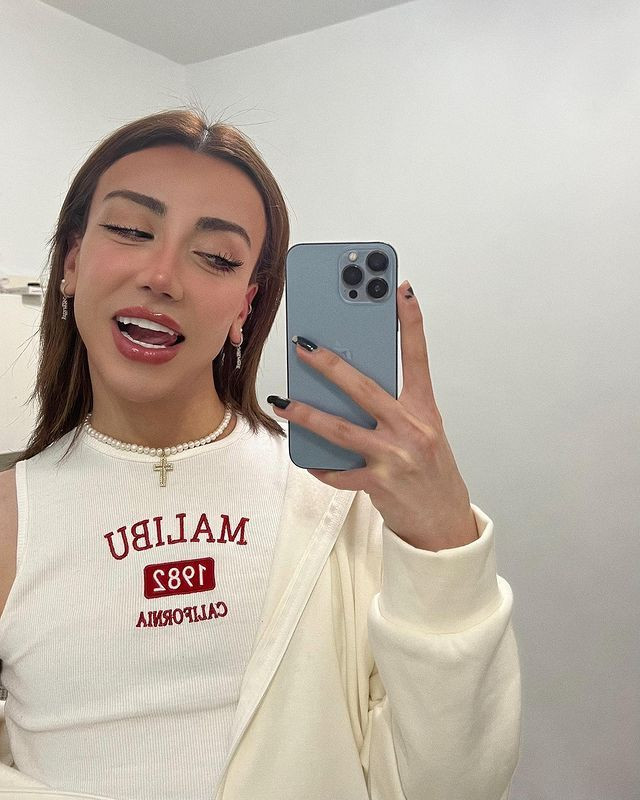 Sosyal medya fenomeni Mika Can Raun estetik operasyon geçirdi! Bambaşka bir yüze sahip oldu - Sayfa 21