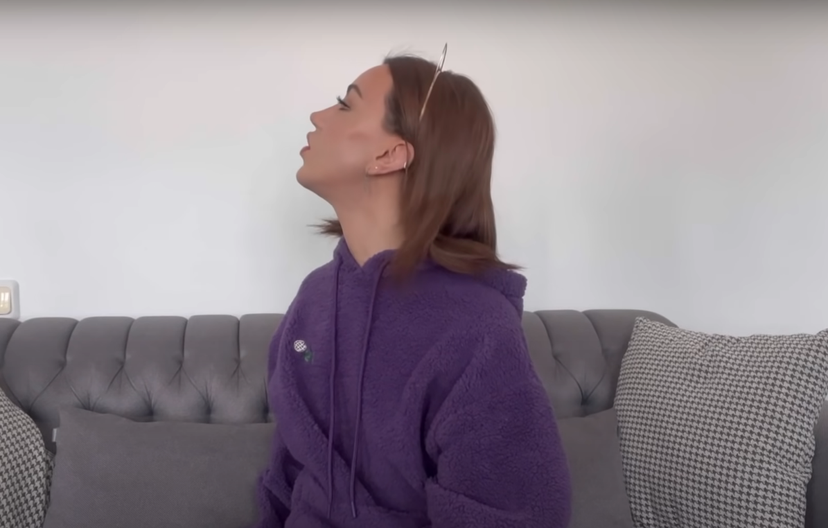 Sosyal medya fenomeni Mika Can Raun estetik operasyon geçirdi! Bambaşka bir yüze sahip oldu - Sayfa 16