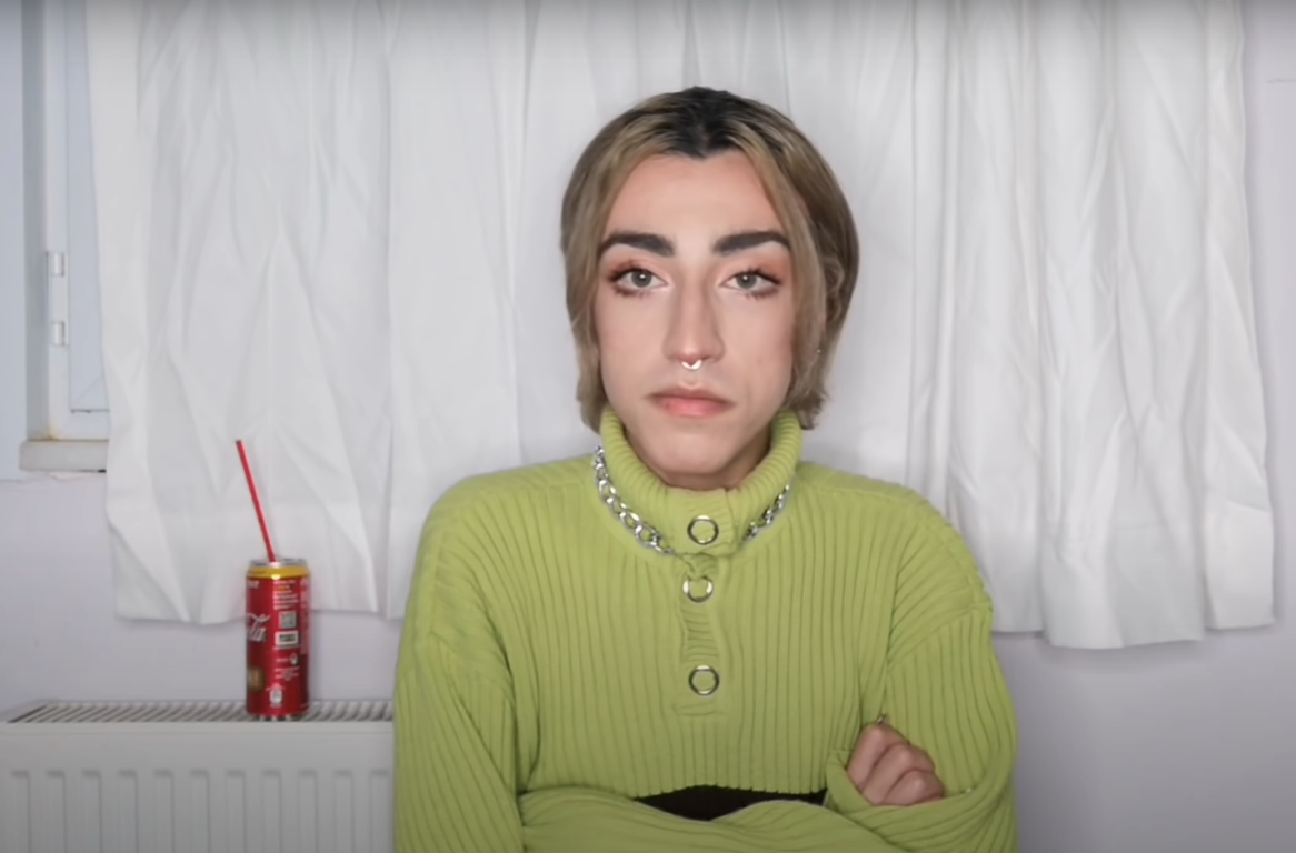 Sosyal medya fenomeni Mika Can Raun estetik operasyon geçirdi! Bambaşka bir yüze sahip oldu - Sayfa 7