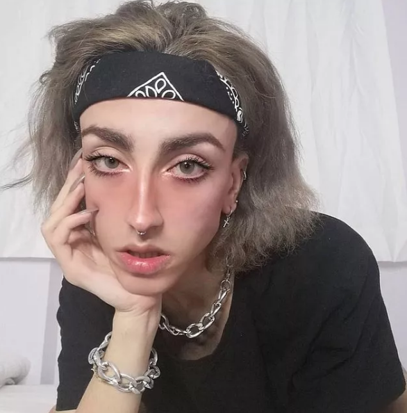 Sosyal medya fenomeni Mika Can Raun estetik operasyon geçirdi! Bambaşka bir yüze sahip oldu - Sayfa 6