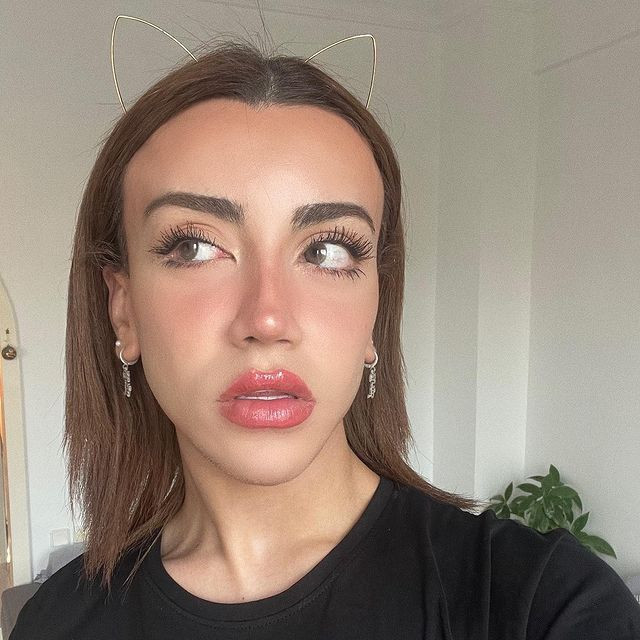 Sosyal medya fenomeni Mika Can Raun estetik operasyon geçirdi! Bambaşka bir yüze sahip oldu - Sayfa 28