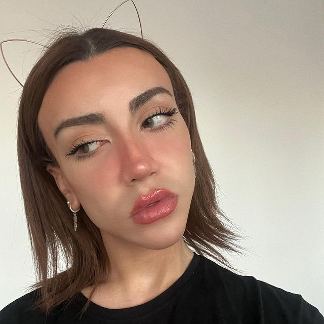 Sosyal medya fenomeni Mika Can Raun estetik operasyon geçirdi! Bambaşka bir yüze sahip oldu - Sayfa 17