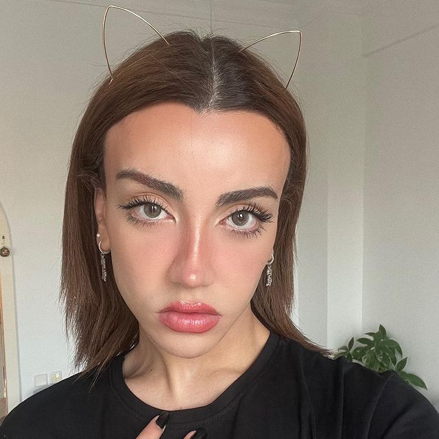 Sosyal medya fenomeni Mika Can Raun estetik operasyon geçirdi! Bambaşka bir yüze sahip oldu - Sayfa 31