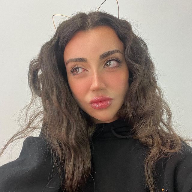 Sosyal medya fenomeni Mika Can Raun estetik operasyon geçirdi! Bambaşka bir yüze sahip oldu - Sayfa 26