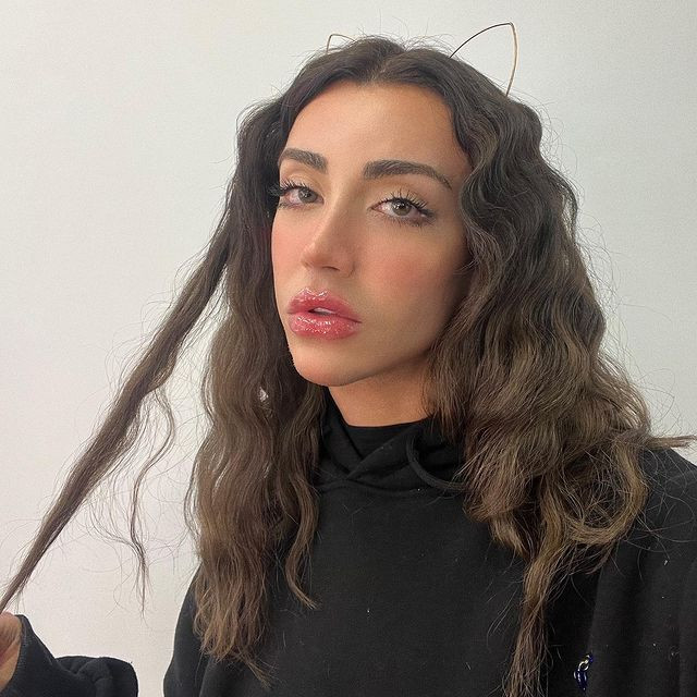 Sosyal medya fenomeni Mika Can Raun estetik operasyon geçirdi! Bambaşka bir yüze sahip oldu - Sayfa 14