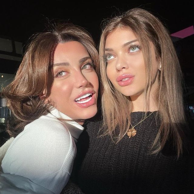 Sosyal medya fenomeni Mika Can Raun estetik operasyon geçirdi! Bambaşka bir yüze sahip oldu - Sayfa 34