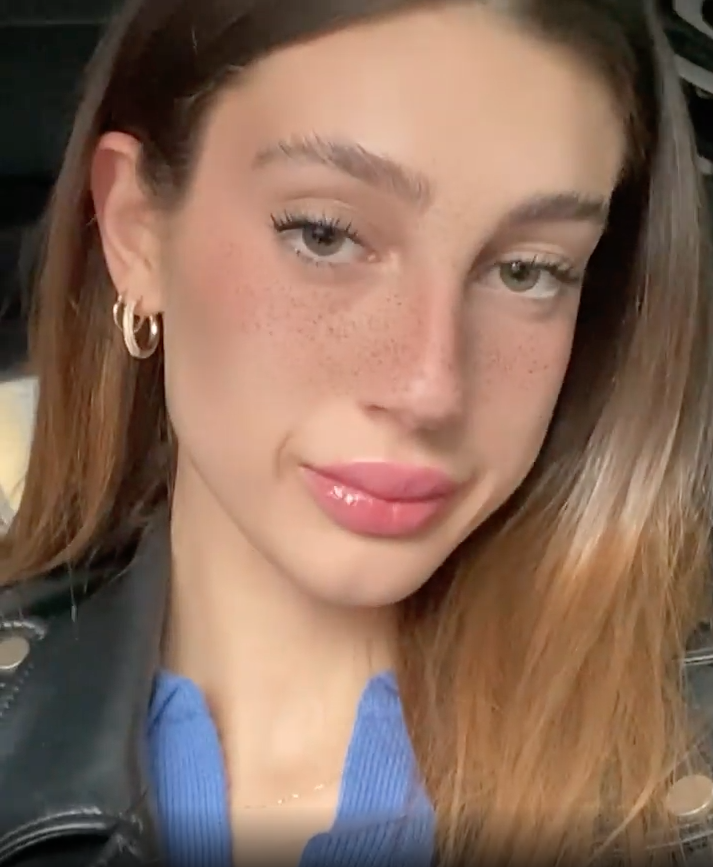 Bir dönem Acun Ilıcalı ile aşk yaşadığı iddia edilen genç model Itır Esen estetik harikası çıktı - Sayfa 30