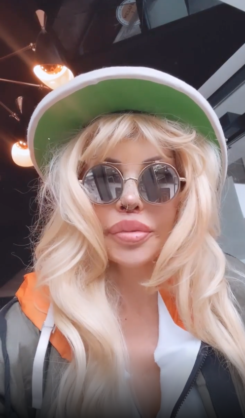 Filiz Akın'a benzemek için ölümü göze aldı! Sisi lakaplı Seyhan Soylu 10 farklı estetik operasyon geçirdi - Sayfa 23