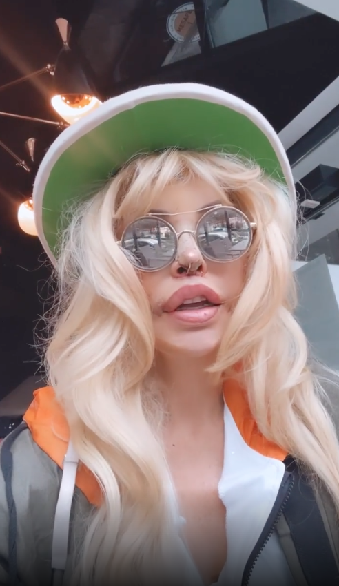 Filiz Akın'a benzemek için ölümü göze aldı! Sisi lakaplı Seyhan Soylu 10 farklı estetik operasyon geçirdi - Sayfa 25