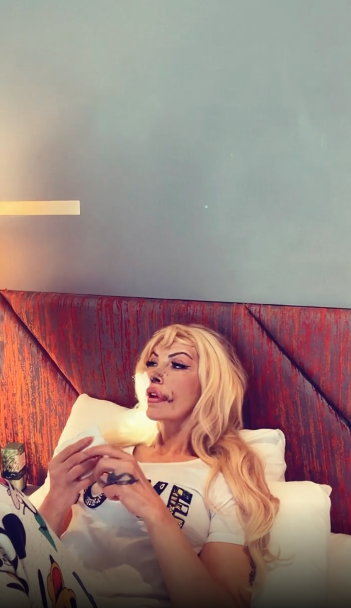 Filiz Akın'a benzemek için ölümü göze aldı! Sisi lakaplı Seyhan Soylu 10 farklı estetik operasyon geçirdi - Sayfa 24