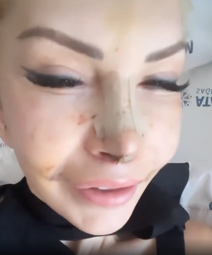 Filiz Akın'a benzemek için ölümü göze aldı! Sisi lakaplı Seyhan Soylu 10 farklı estetik operasyon geçirdi - Sayfa 7