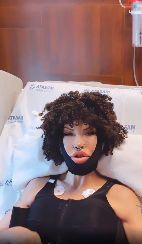 Filiz Akın'a benzemek için ölümü göze aldı! Sisi lakaplı Seyhan Soylu 10 farklı estetik operasyon geçirdi - Sayfa 8