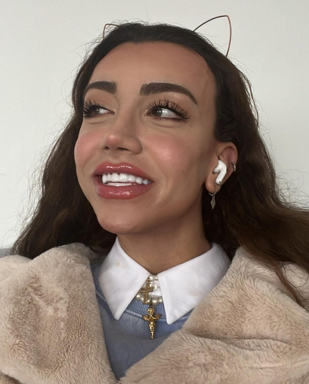 Sosyal medya fenomeni Mika Can Raun estetik operasyon geçirdi! Bambaşka bir yüze sahip oldu - Sayfa 13