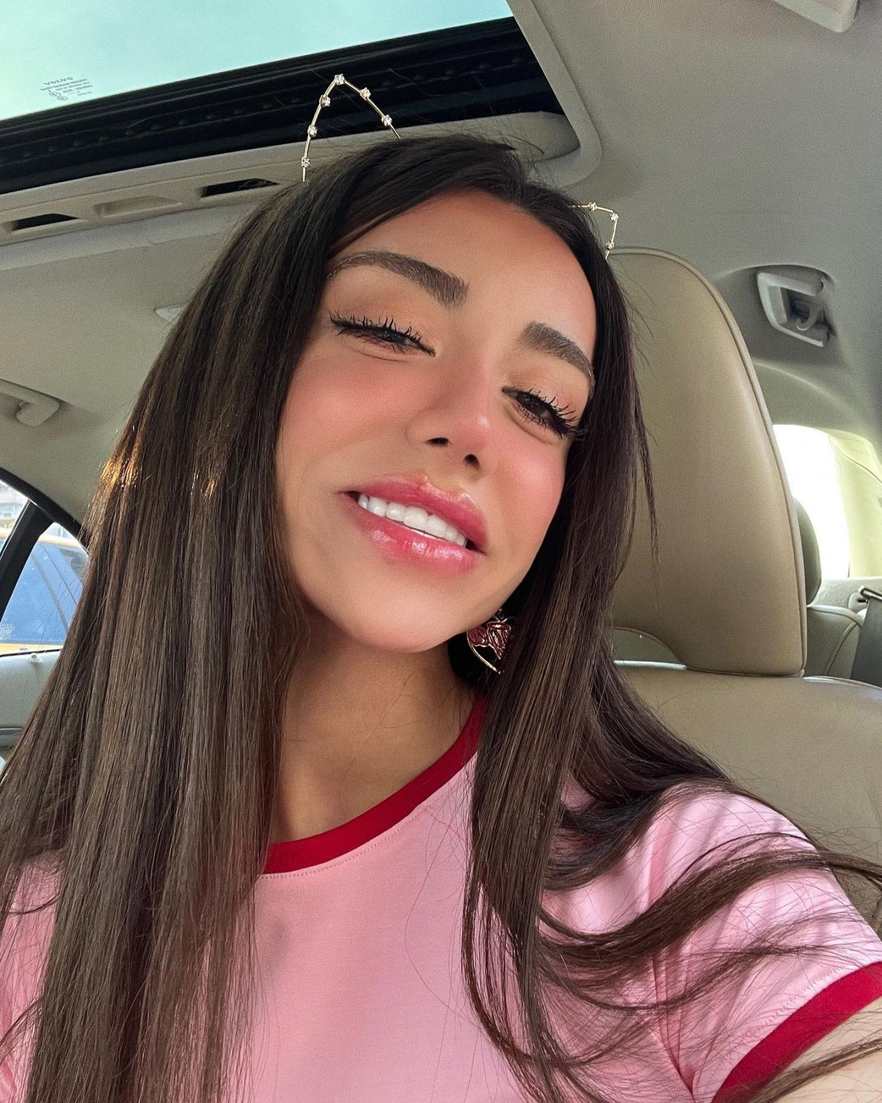 Sosyal medya fenomeni Mika Can Raun estetik operasyon geçirdi! Bambaşka bir yüze sahip oldu - Sayfa 10