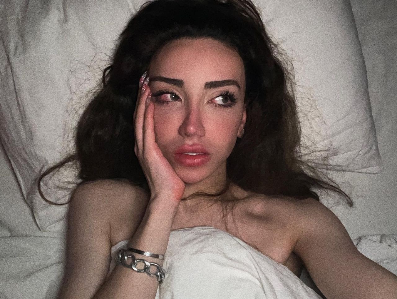 Sosyal medya fenomeni Mika Can Raun estetik operasyon geçirdi! Bambaşka bir yüze sahip oldu - Sayfa 12