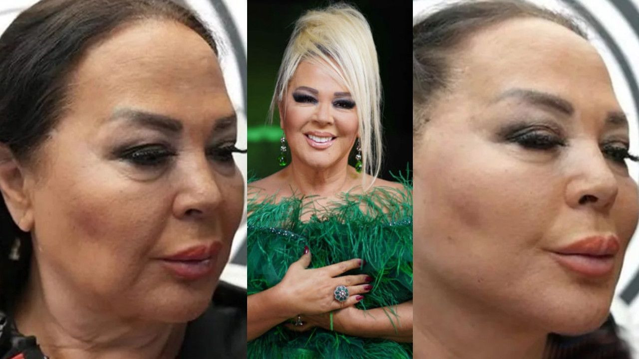 Listenin başında Seda Sayan var! İşte Fransız Askısı estetiği yaptıran ünlü isimler - Sayfa 9