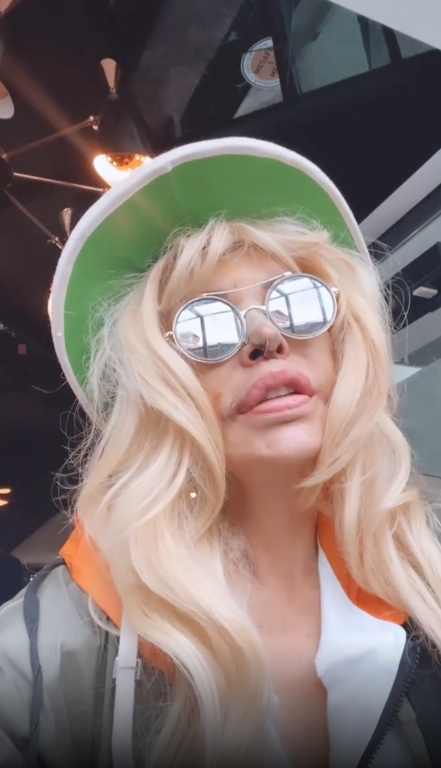 Filiz Akın'a benzemek için estetik operasyon geçiren Seyhan Soylu son haliyle 'yok artık' dedirtti - Sayfa 7