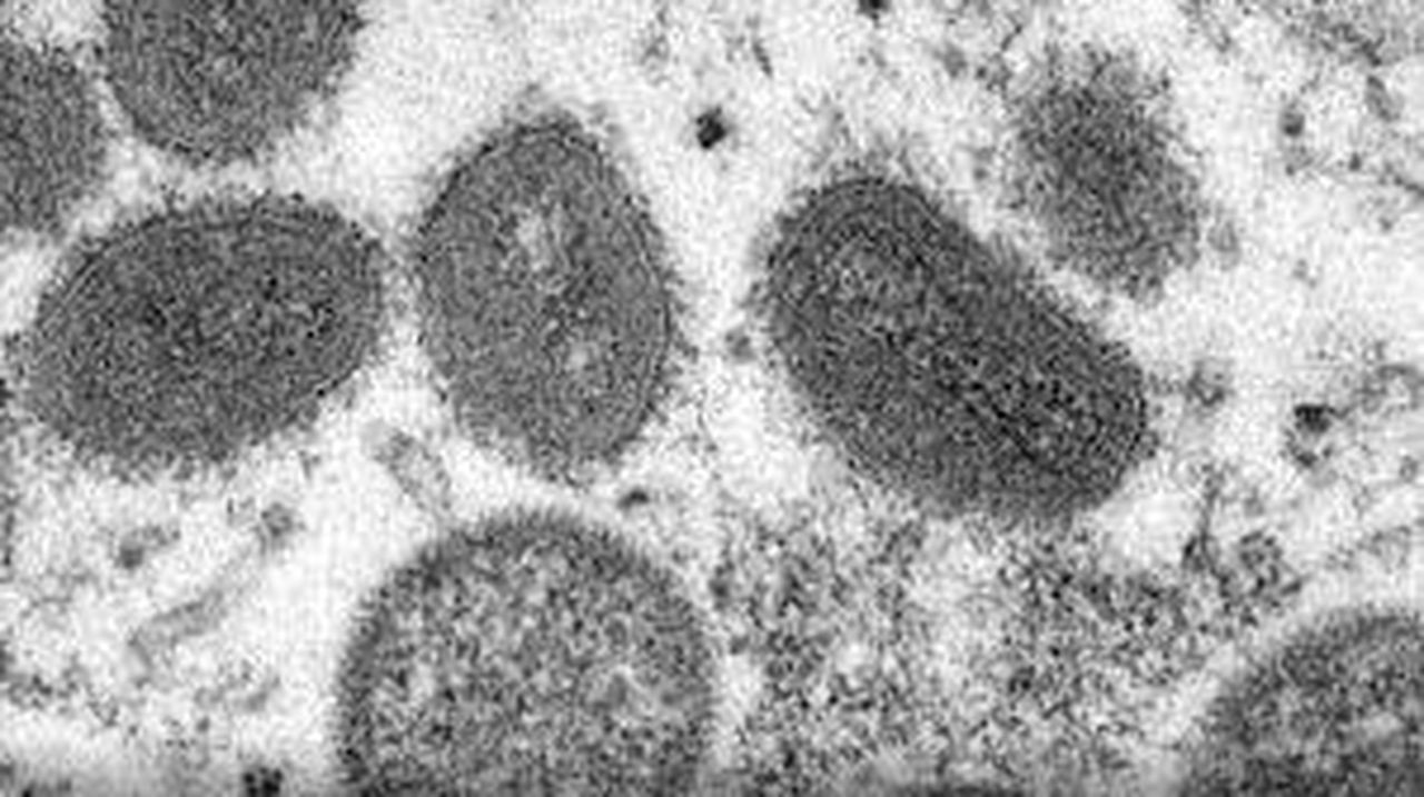 Maymun çiçeği Latin Amerika'ya da sıçradı - Sayfa 6