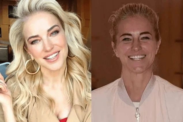 Ünlülerin Makyajsız Halleri Rüyalara Giriyor! Burcu Özberk, Ebru Şahin, Aline Boz Makyajsız Halleri! - Sayfa 15