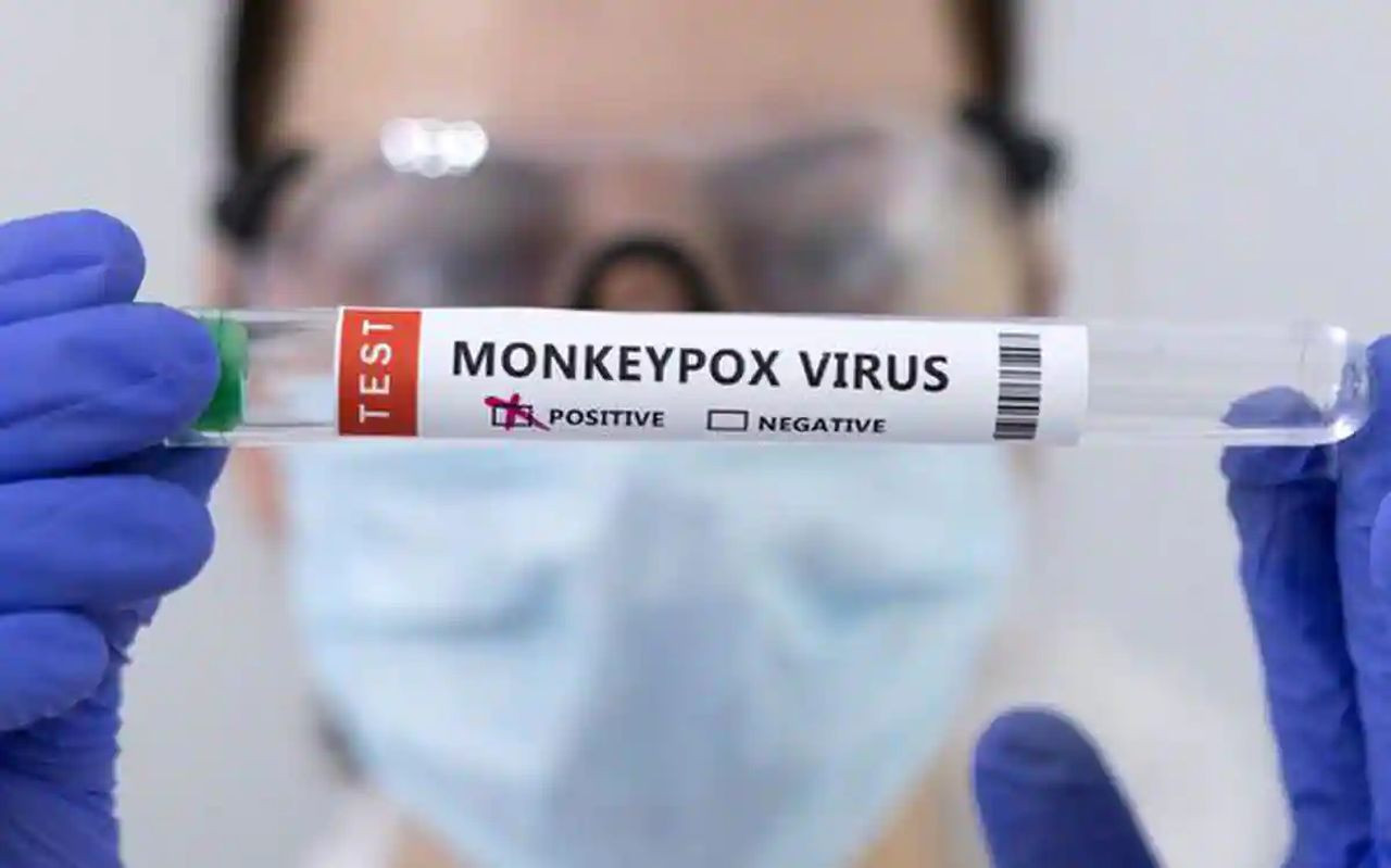 DSÖ, maymun çiçeği virüsünün ismini değiştiriyor! İşte sebebi - Sayfa 6