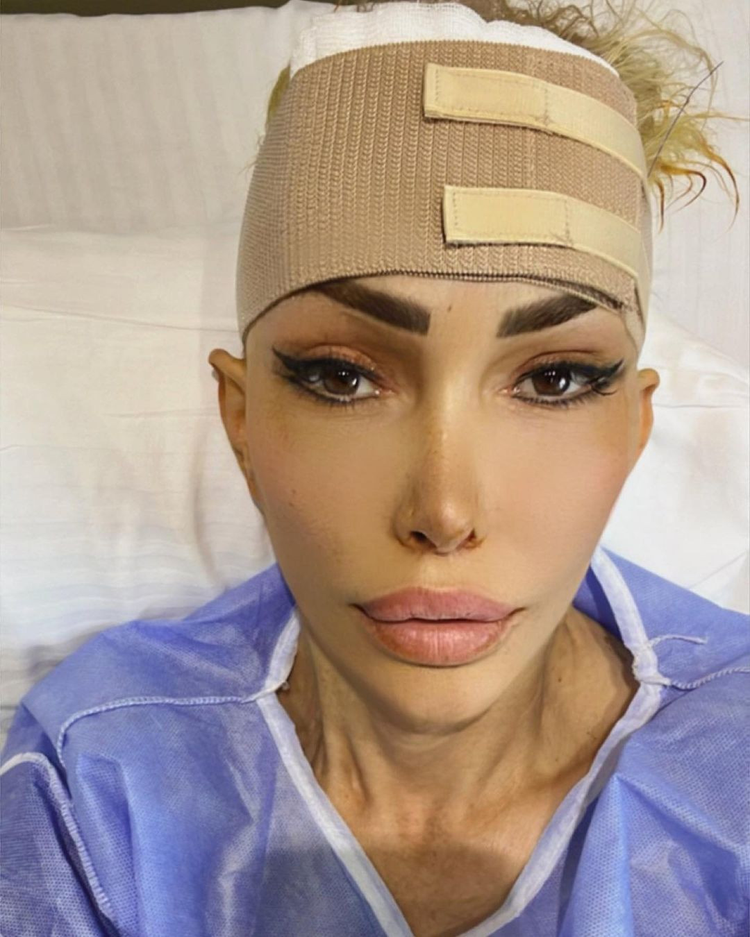 Ata Çağlayan'la aşk yaşayan Seyhan Soylu son haliyle Seda Sayan'a benzetilince bir estetik operasyon daha geçirdi - Sayfa 10