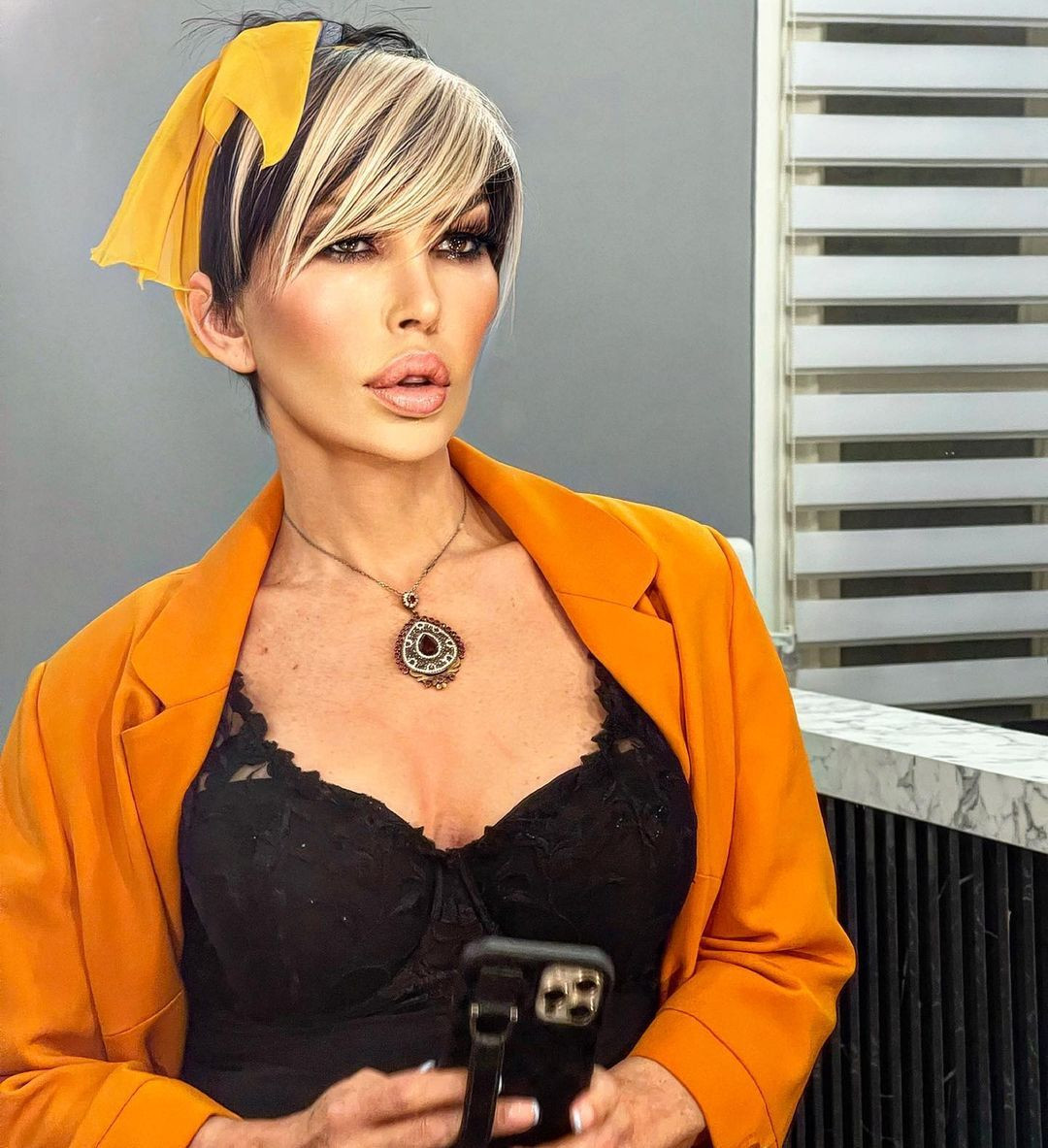 Ata Çağlayan'la aşk yaşayan Seyhan Soylu son haliyle Seda Sayan'a benzetilince bir estetik operasyon daha geçirdi - Sayfa 20