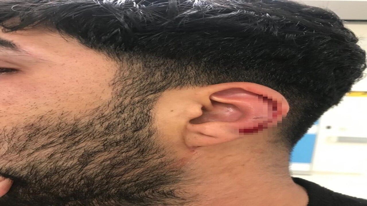 Tekme, yumruk, sopa ve falçatanın havada uçuştuğu kavga anı kamerada! - Sayfa 11