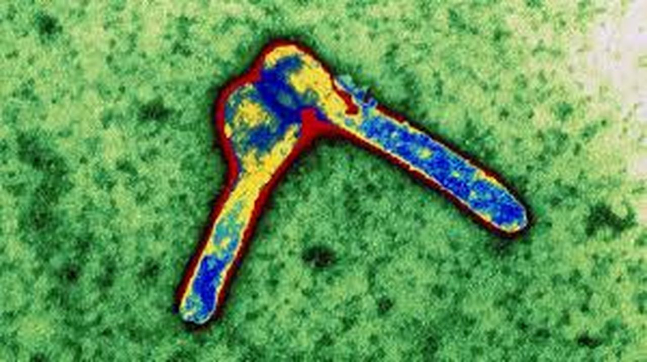 Marburg humması salgını! Aşısı ve özel tedavisi yok, ölüm oranı yüzde 90'a ulaşıyor - Sayfa 8