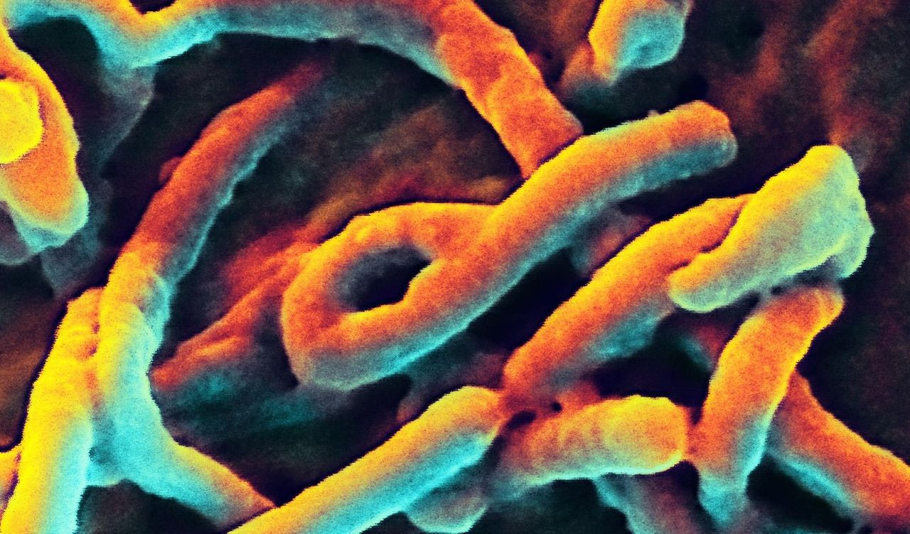 Marburg humması salgını! Aşısı ve özel tedavisi yok, ölüm oranı yüzde 90'a ulaşıyor - Sayfa 5