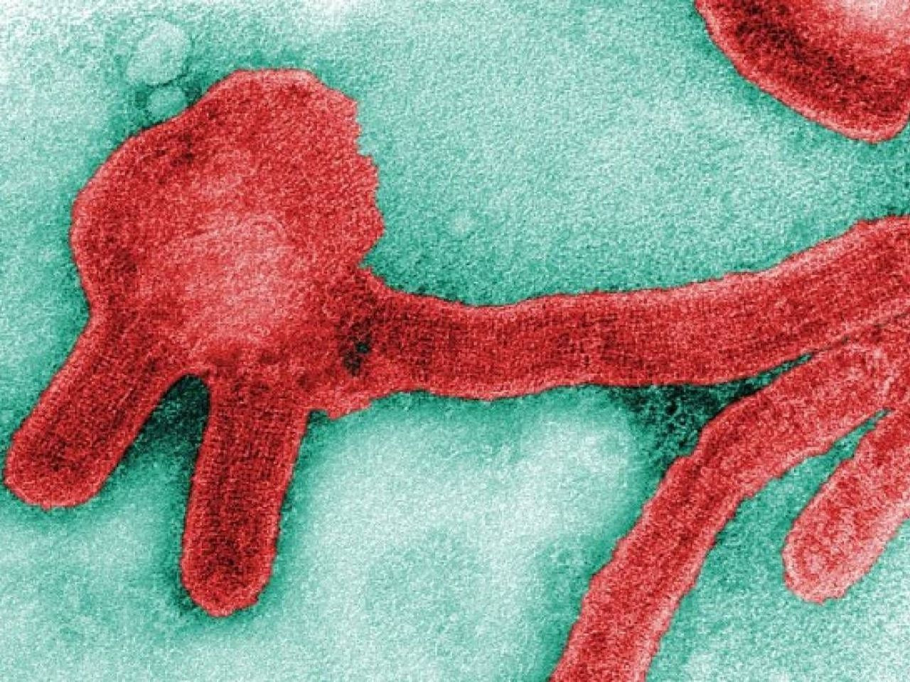 Marburg humması salgını! Aşısı ve özel tedavisi yok, ölüm oranı yüzde 90'a ulaşıyor - Sayfa 6