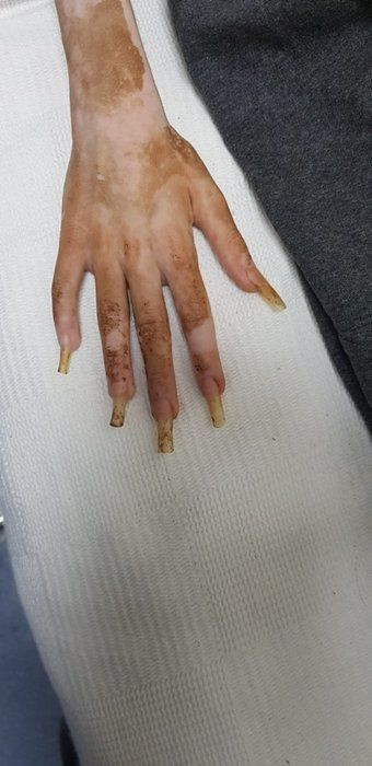 Çöp evde yeğenini mahsur bırakan teyzeden akılalmaz savunma: Annesi olmadığımı öğrenince hayata küstü! - Sayfa 13