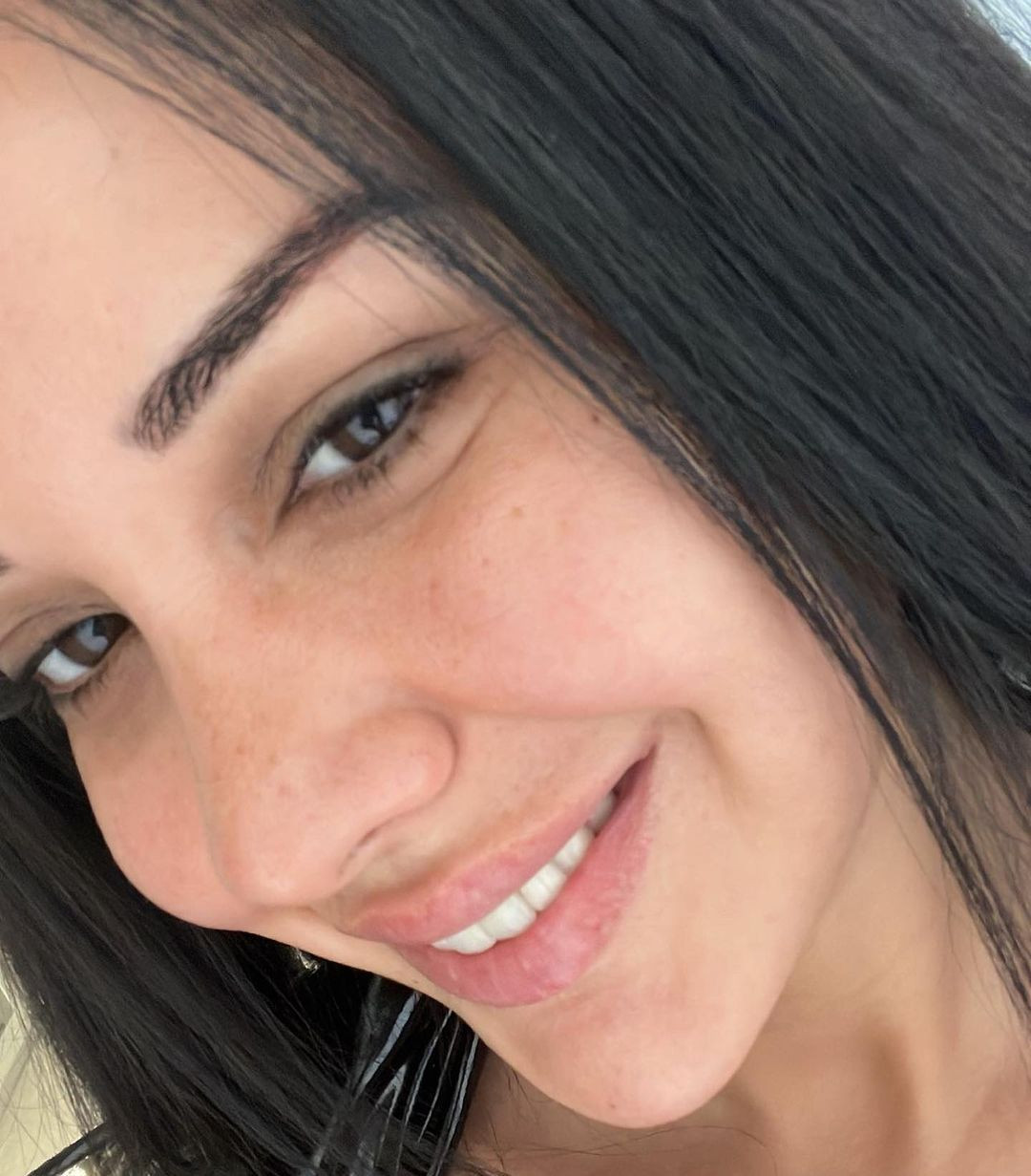 Eski halini tanıyamayacaksınız! Fenomen Dilan Polat'ın estetiksiz fotoğrafları ortaya çıktı - Sayfa 14