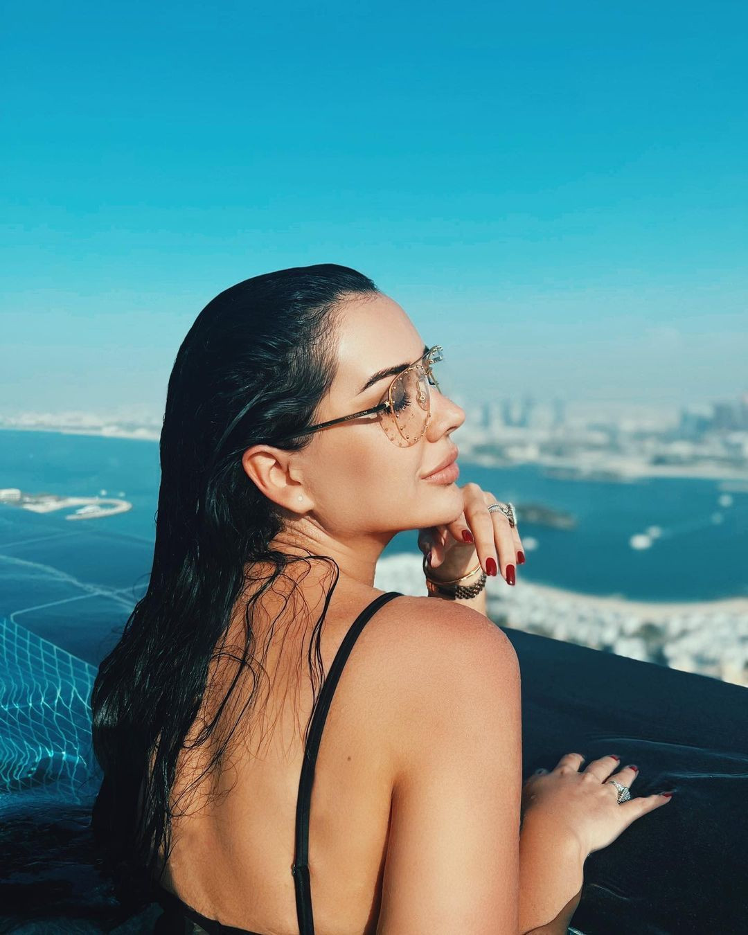 Eski halini tanıyamayacaksınız! Fenomen Dilan Polat'ın estetiksiz fotoğrafları ortaya çıktı - Sayfa 13