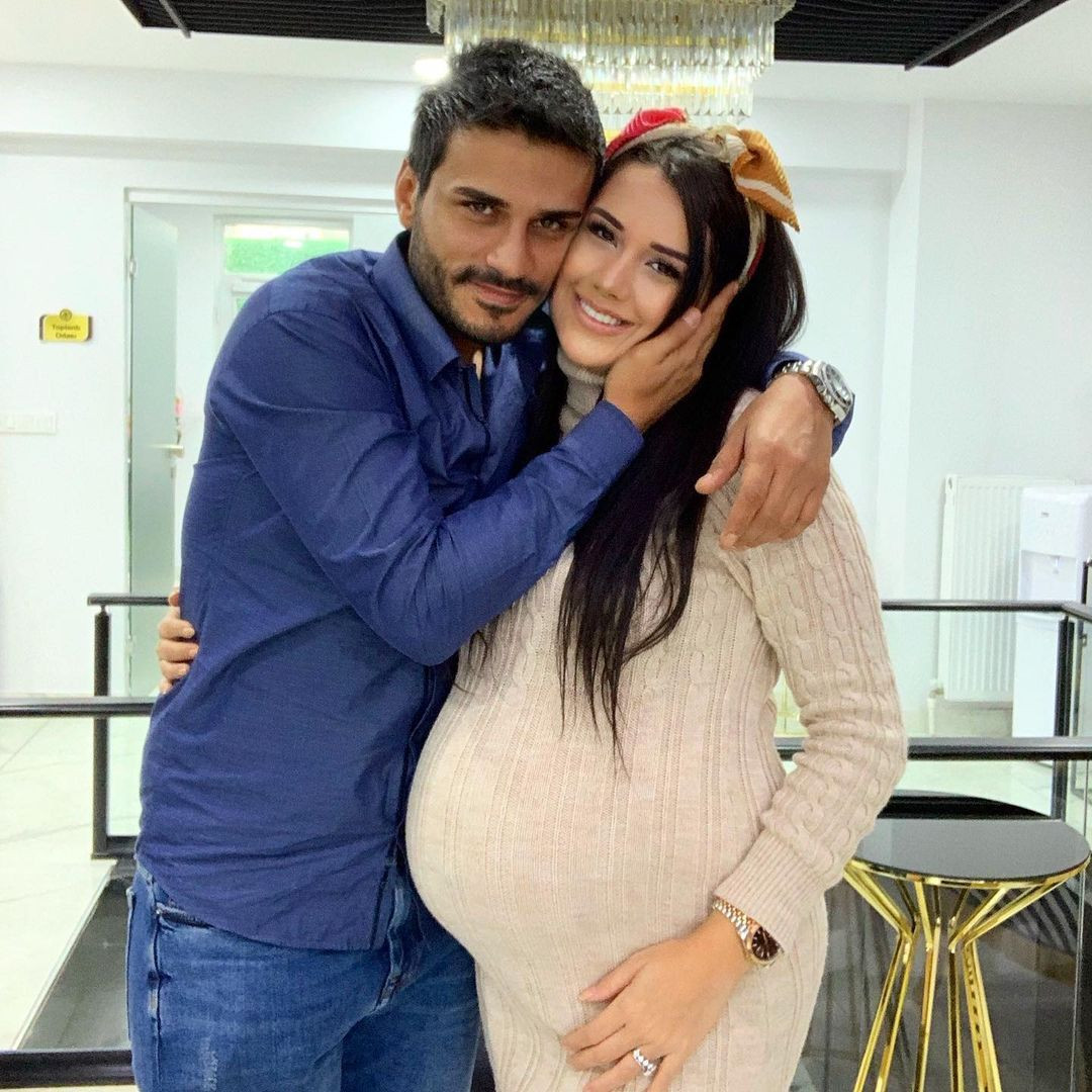 Eski halini tanıyamayacaksınız! Fenomen Dilan Polat'ın estetiksiz fotoğrafları ortaya çıktı - Sayfa 31