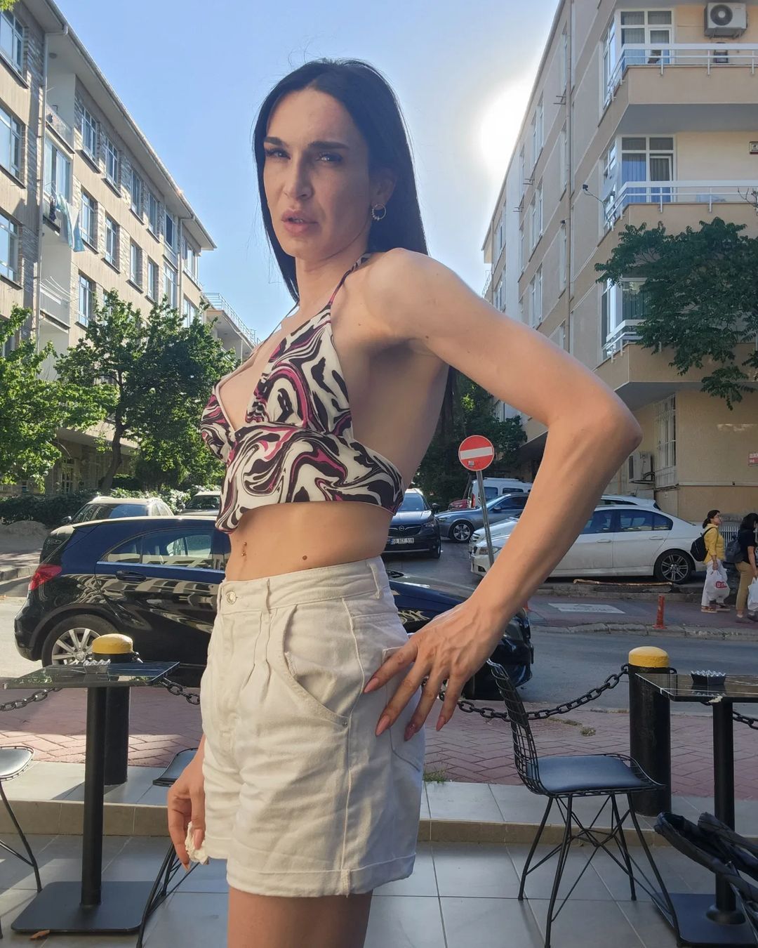 Değişimin böylesi! Cinsiyet değiştiren Ahmet Melih Yılmaz son halini paylaştı - Sayfa 8