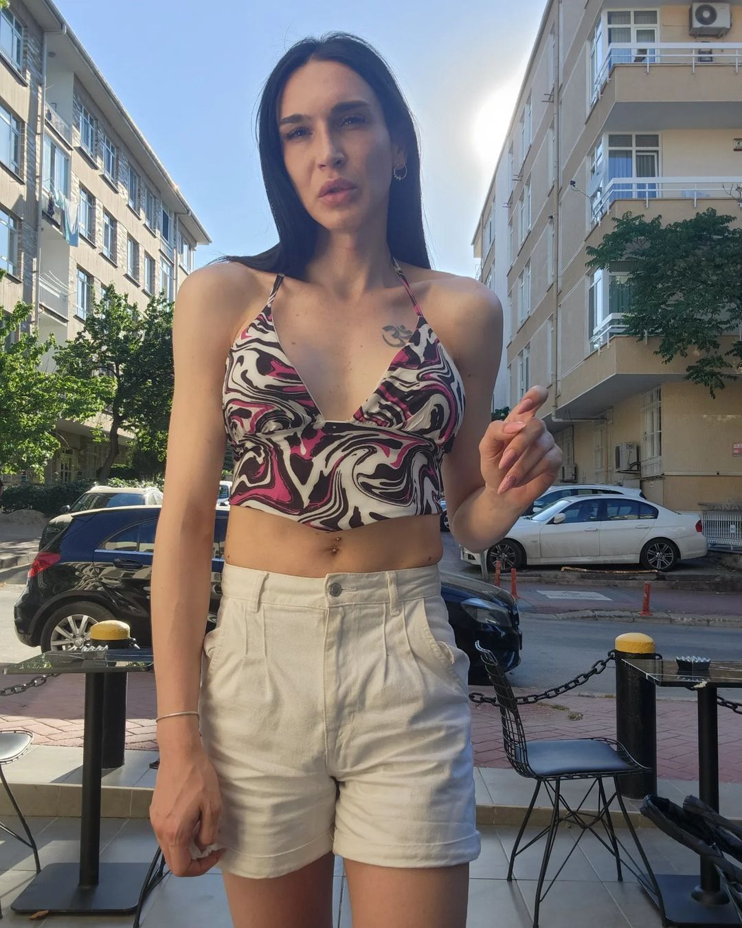 Değişimin böylesi! Cinsiyet değiştiren Ahmet Melih Yılmaz son halini paylaştı - Sayfa 7