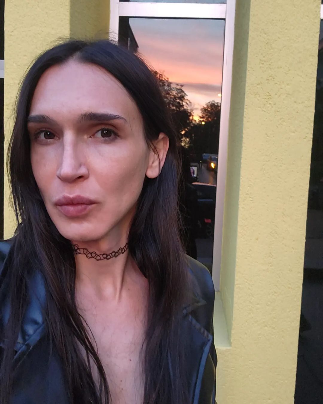 Değişimin böylesi! Cinsiyet değiştiren Ahmet Melih Yılmaz son halini paylaştı - Sayfa 10