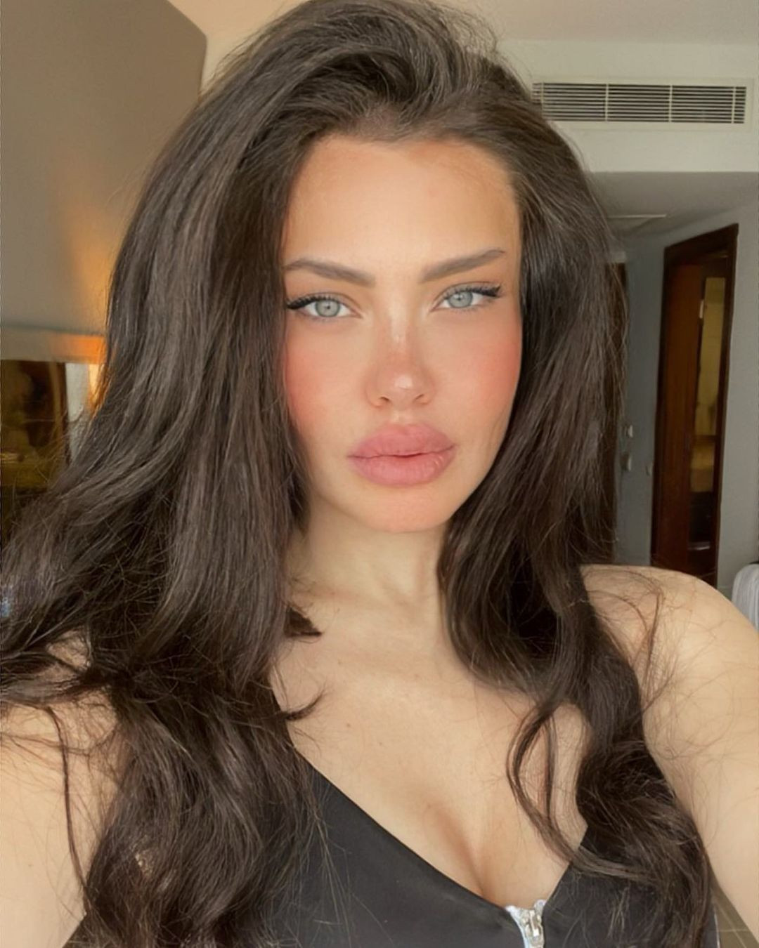 Yok böyle değişim! Bir döneme damga vuran şarkıcı Lara estetiksiz haliyle gündem oldu - Sayfa 11