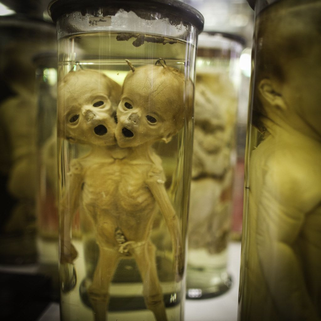 Dünyanın en korkunç 10 müzesi! - Sayfa 9