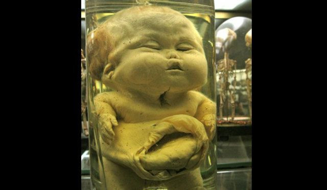 Dünyanın en korkunç 10 müzesi! - Sayfa 8